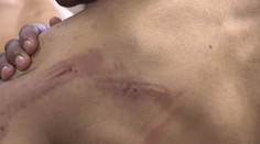 Neprimeraný útok na Rómov má prvého obvineného