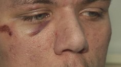 Jazda dvoch mladíkov sa zmenila na nočný horor. Jeden z nich skončil v nemocnici