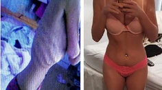 Anorektička o chorobe bez cenzúry. Z pohľadu na ňu mrazí