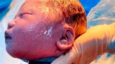 Lekári neverili vlastným očiam. Bábätko malo okolo krku šesťkrát omotanú pupočnú šnúru