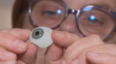 V detstve prišiel o oko, pretože zaklamal, že mu doň niečo spadlo. Protézy sú dnes už na nerozoznanie