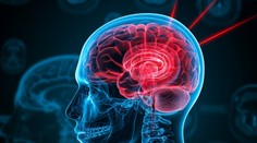 Vedcom sa podarilo vyriešiť hlavný problém liekov na migrénu. Vyvinuli taký, ktorý zaberá okamžite