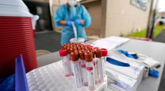 Po utorku máme 37 nových pacientov s COVID-19, stúpol aj počet vyliečených