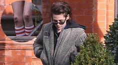 Hviezda Twilightu vystrašila fanúšikov. Je samá modrina