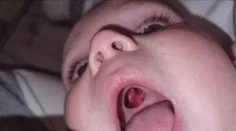 Ženu vystrašila diera v ústach bábätka. Keď sestrička zistila, o čo ide, smiech sa im nezastavil