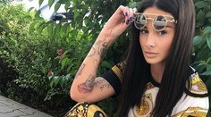 Plačková už netají, čo si dala operovať. Ukázala sa po zákroku