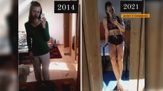 Kedysi trpela anorexiou. Dnes svojou cieľavedomosťou inšpiruje ďalších mladých ľudí