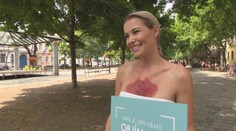 Niektorí sa jej stále boja. Pozrite si reakcie Slovákov na figurantku so psoriázou