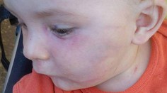 Zúfalá matka! Vychovávateľka jej vraj takto dobila 9-mesačného syna