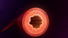 Koronavírus napáda aj cievy. Vysvetľuje to príznaky COVID-19, ktoré boli pre vedcov záhadou