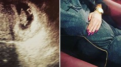 Prvé dieťa na ceste! Vyplastikovaná bývalá markizáčka je v radostnom očakávaní