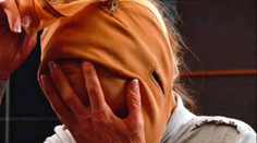 Moment, na ktorý všetci čakali: Znetvorená Dana (28) si strháva masku a šokuje svet!