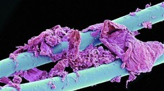 Videli ste už použitú zubnú niť alebo toaletný papier pod mikroskopom?