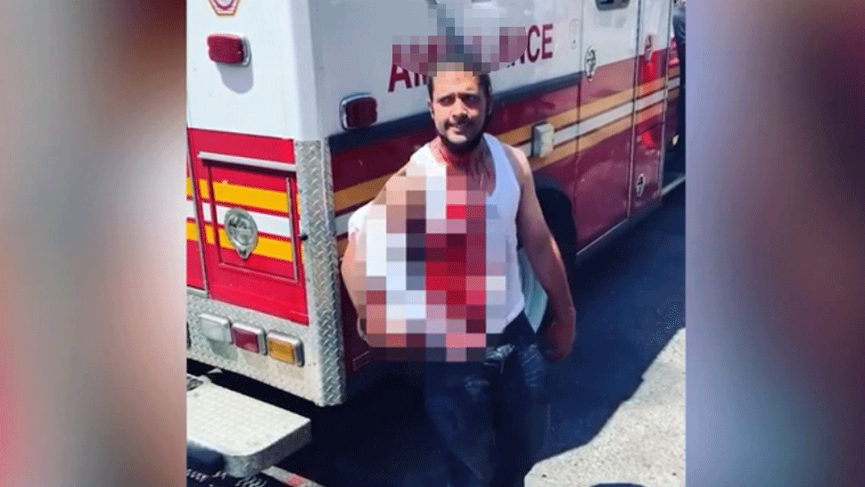 Muž s nožom zabodnutým v hlave pokojne kráčal po ulici. Ľudia si ho nakrúcali na telefóny