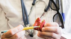 Seriál Špecialisti: Navštívili sme endokrinologickú ambulanciu