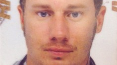 Cyril chcel vyzerať ako Marilyn Monroe. Toto je výsledok pekelne drahých procedúr