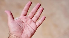 Máte po kúpeli vrásky na prstoch? Na jednej strane je za tým evolúcia, na druhej môže ísť varovný signál