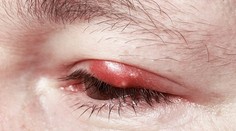 Nikdy nechoďte spať bez odlíčenia. Odborníčka varuje pred následkami na zdraví