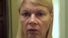 Keď plastika fakt pomôže. Neuveríte, aká kráska je z tejto ženy