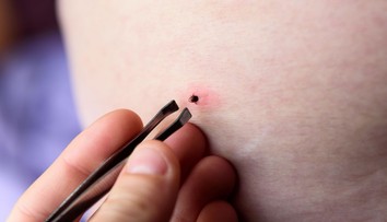 Robíte to takto? Odborníčka vysvetlila, ako správne vyberať kliešte