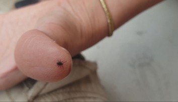 Slovensko je semeniskom zákernej kliešťovej choroby. Nakazených je stále viac, takto sa dá brániť