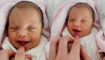 Lekári zostali v šoku. Na strednom Slovensku sa narodilo bábätko so zubom