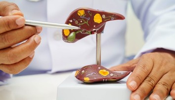 Rozmáha sa ťažká choroba. Varovné signály Slováci objavujú neskoro