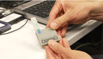 Prelomový vynález českých vedcov. Test dokáže za pár minút odhaliť pohlavnú chorobu z kvapky moču