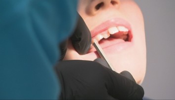 Termíny sa plnia, oneskorenci si budú platiť zubára sami. Lekári varujú pred koncom roka