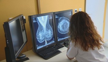 Preventívne sono prsníkov končí. Ženy sa vraj majú spoliehať na samovyšetrenie, časť lekárov protestuje