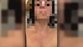 Týraná žena sa bojí o život. Generálna prokuratúra reaguje, chystá sa prešetriť konanie kompetentných