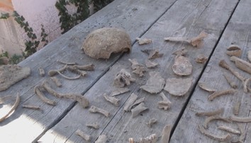 Kopali kanalizáciu, v hline našli viacero ľudských kostí