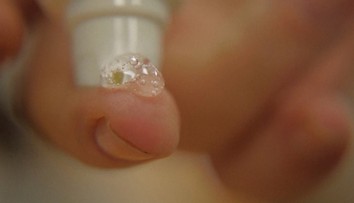 Zázračný liek z Ruska. V rekordnom čase vylieči ranu