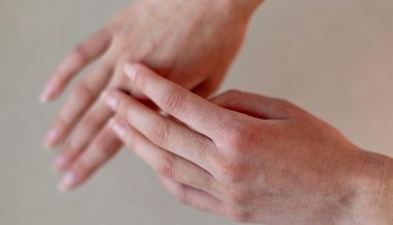 Zima poškodzuje pokožku viac, než si myslíte. Dermatologička radí, čo pomáha