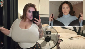 Austrálčanka trpí vzácnou poruchou. Prsia jej začali nekontrolovateľne rásť, keď mala 25 rokov