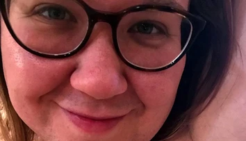 Leah dlhé roky skrývala svoje telo. Keď uvidíte fotografie, pochopíte prečo
