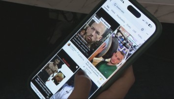 Údery do lícnych kostí či karfiolové ucho. Lekári varujú pred nebezpečnými trendmi mladých
