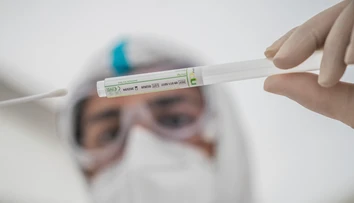 Blížime sa k stropu: Kapacity PCR testov môžeme naplniť už o pár dní