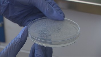 Hygienici stále testujú vzorky z kúpaliska v Štúrove. Boli sme sa pozrieť, ako skúmajú améby priamo v laboratóriách