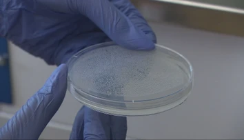 Hygienici stále testujú vzorky z kúpaliska v Štúrove. Boli sme sa pozrieť, ako skúmajú améby priamo v laboratóriách