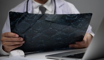 Mŕtvica je pravdepodobnejšia u ľudí s jednou krvnou skupinou. Vedci odhaľujú prekvapivé súvislosti