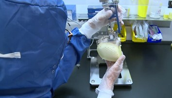 Pomôže zachrániť životy státisícom ľudí. Francúzi vyvinuli kompletne umelé srdce