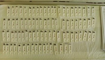 Zisťovali sme, aké sú priebežné výsledky plošného testovania v rizikových zariadeniach