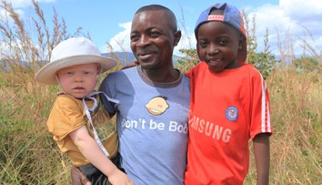 Vraždenie albínov pokračuje, časti ich tiel využívajú na "tradičnú medicínu"