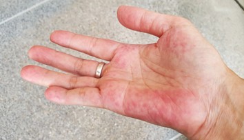 Únava nemusí prísť len s jesenným počasím. Tichého zabijaka indikujú viaceré príznaky