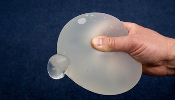 Žene zachránil život silikónový implantát, ktorý odklonil projektil mieriaci do srdca