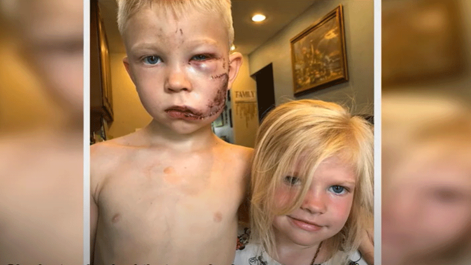 Malý hrdina. Šesťročný chlapec zachránil svoju sestru pred útokom psa