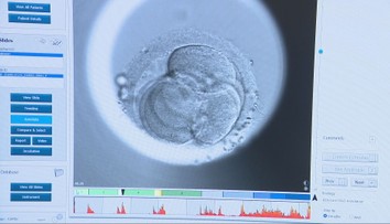 Alarmujúca situácia na Slovensku: Neplodný je každý siedmy pár. Čoraz viac vyhľadávajú pomoc reprodukčných kliník