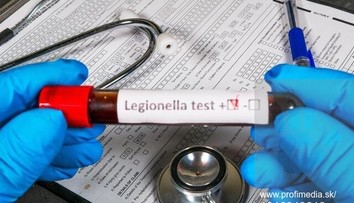 V hotelovej vírivke v Demänovskej Doline potvrdili prítomnosť baktérie Legionella