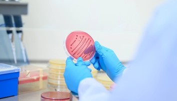 Nebezpečná kvasinka zabíja až 60 % infikovaných. Prvé prípady potvrdili už aj u našich susedov